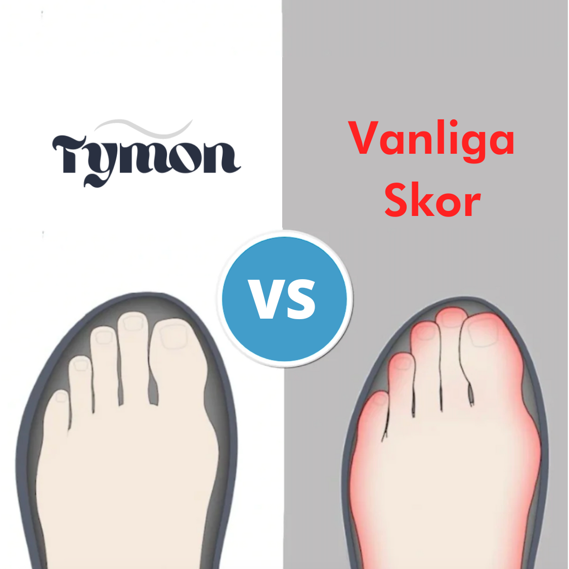 Ortopediska Skor - kvinnor